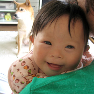 トップ100 可愛い ダウン症 赤ちゃん 最高の動物画像