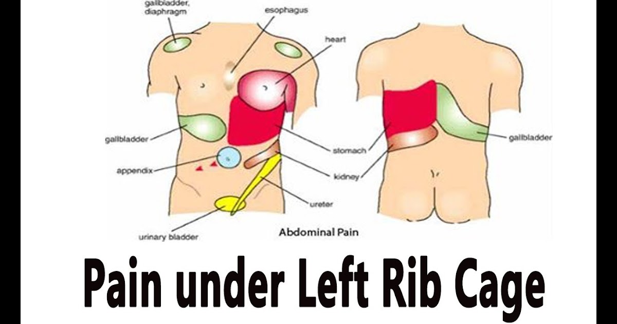 Picture Of What Is Under Your Rib Cage : What Is Causing ...