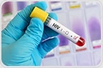 New study unravels secrets of HIV's persistence