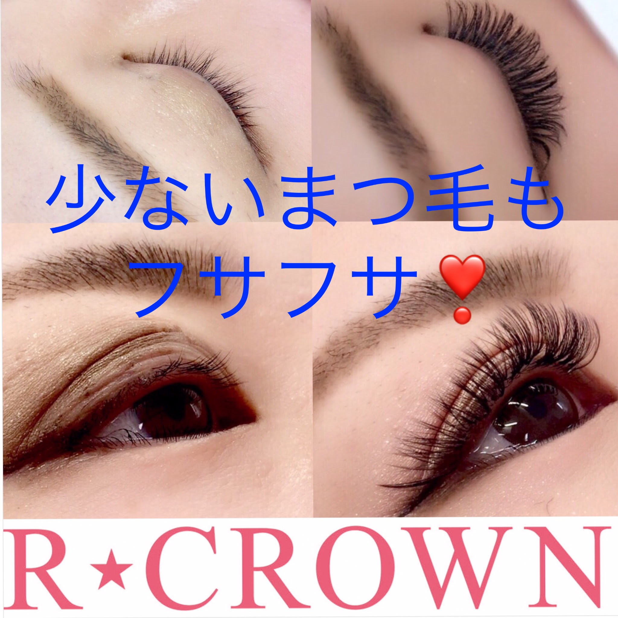 最も欲しかった マツエク 下手 画像 マツエク 下手 画像 Viewjpgazo