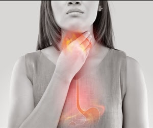 Gastroesophageal reflux disease may affect nearly a third of U.S. adults every week