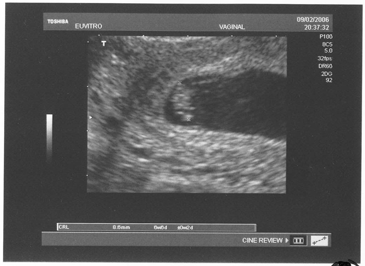 Cuanto Mide Un Bebe De 8 Semanas De Embarazo Consejos De Bebe