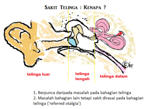 Ubat Sakit Telinga Tersumbat - Contoh Gaes