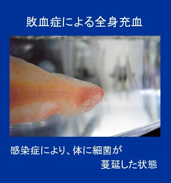綺麗なウーパールーパー エラ 短い 最高の花の画像