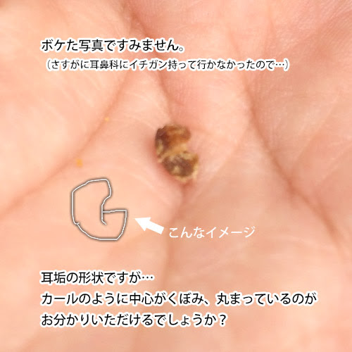 ベスト50 子供 耳垢 茶色 かわいい子供たちの画像