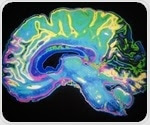 Powerful imaging technique sheds light on how the brain responds to vascular injury