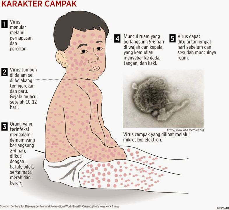 Ubat Demam Campak Gatal - Pertanyaan o
