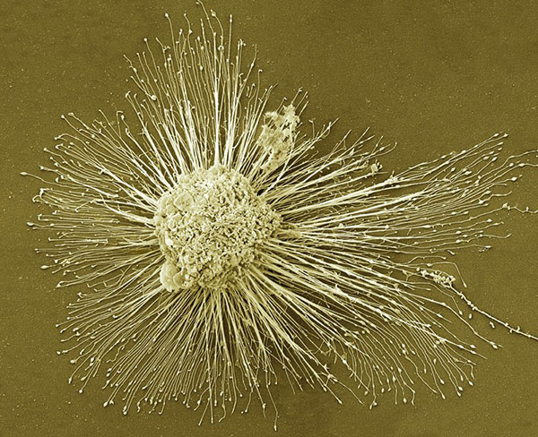 An induced pluripotent stem (iPS) cell.