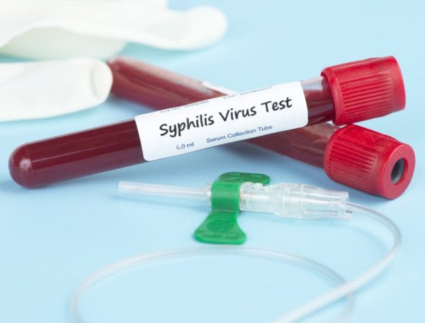 Syphilis wake-up call due to Europe recorded more cases of syphilis than HIV infections, mainly due to an increase in the number of cases among MSM