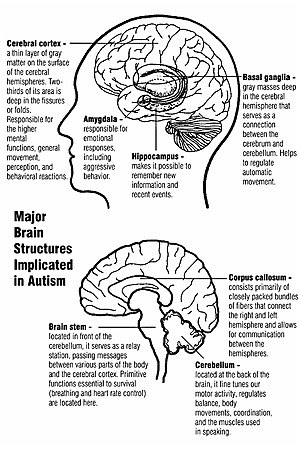 Asperger syndrome (as) is a subtype of autism spectrum disorder (asd) characterized by major problems in social and nonverbal communication, together with limited and repetitive forms of behavior and interests. Aspergers And Autism Brain Differences Found Follow Me Here