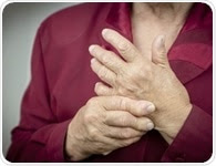 Rheumatoid arthritis found to worsen during and after menopause, study says