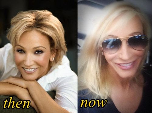 Pastor Paula White plastic surgery before and after photos ...