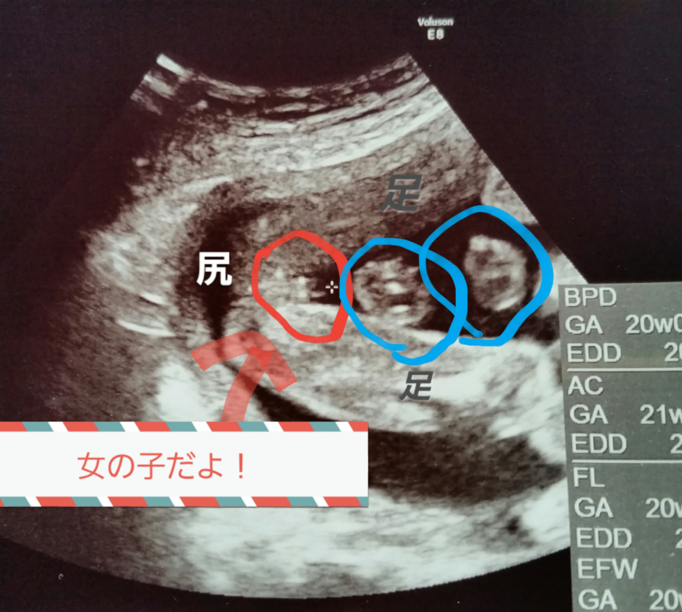 イメージカタログ 驚くばかり 妊娠 14 週 性別