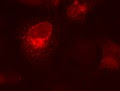 HPV-16 E5 Oncoprotein