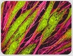 The Different Roles of Actin Within Eukaryotic Cells