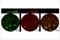 New Endoscope Combines Photoacoustic and Fluorescence Imaging in a Single Device