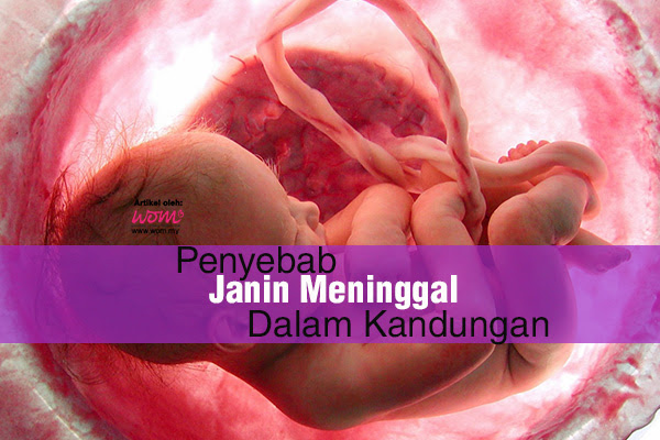 Kepala bayi seolah olah tertunduk dan berada dalam cecair air ketuban atau amnotic sac yang akan memberikan keperluan tumbesaran bayi semasa dalam kandungan. Punca Punca Janin Meninggal Dalam Kandungan Keibubapaan Famili Forum Cari Infonet