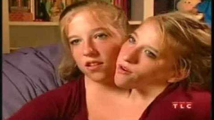 Bit.ly/2ol5mam the amazing abby and brittany hensel are in their final year of college and. Abby Brittany Hensel Conjoined Twins Abigail Brittany Hensel Turn 16 Twins Who Share A Body