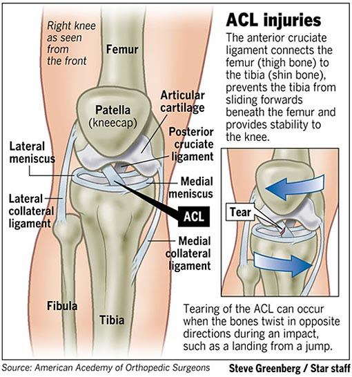 The femur, patella, tibia and fibula, in addition to the major ligaments of the knee joint. Acl Injuries Football And Me Field Gulls