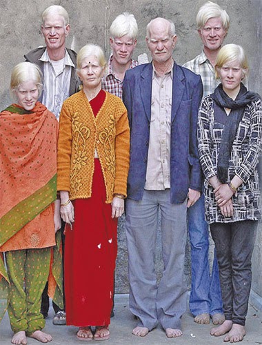 Keluarga Albino terbesar India mahu dicatat Rekod Dunia 