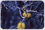 Neurogenesis plays an underappreciated role in the progression of Alzheimer's