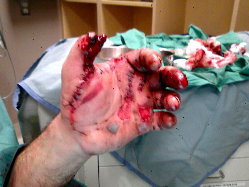 50 Cal Wound - Gun statistics of.50cal equivelents in war ...
