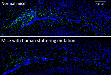 A microscope image of brain cells stained in blue. 