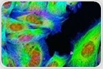 Studying Protein Oligomerization using Fluorescence Microscopy