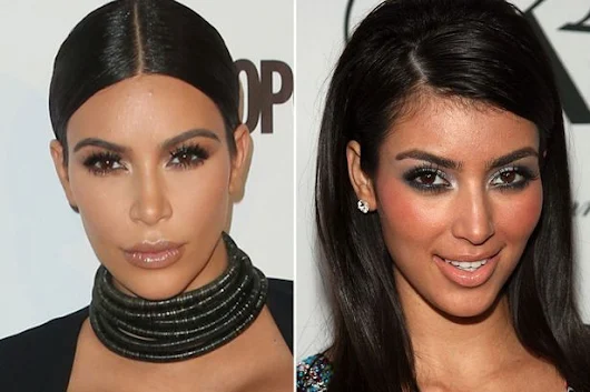 Kim Kardashian REACTS to her Before-Surgery Photos