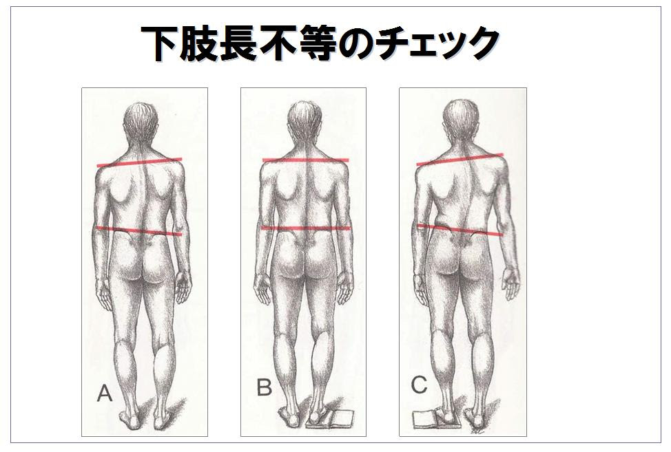 足が短い 原因 足が短い 原因
