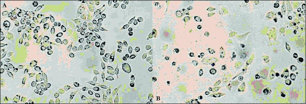 enbrocunlex: Animal Cell Under Light Microscope