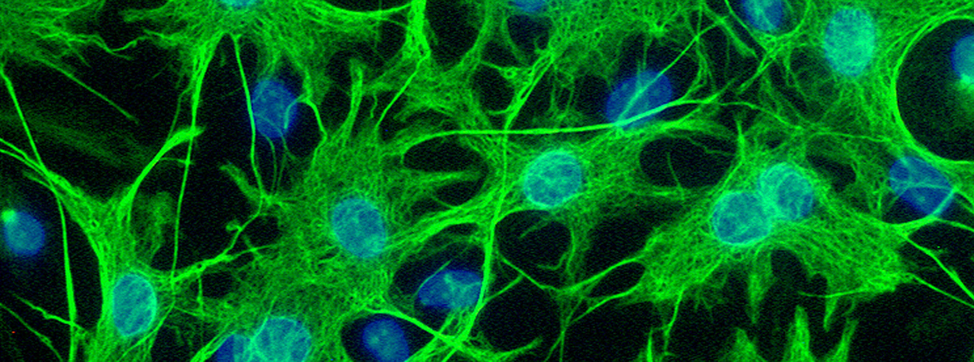 Elle atteint progressivement les neurones et entraîne une faiblesse musculaire puis une paralysie. Fondation Thierry Latran Dediee A La Maladie De Charcot