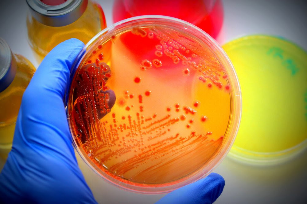 Oral bacteria in CF