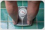 Study: People with severe obesity constantly try to reduce or control their weight