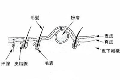 金玉 しこり 睾丸にできもの ニキビやしこりができる理由とその対処法