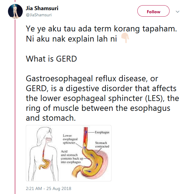 Ubat Sakit Perut Makan Pedas - Rawatan p