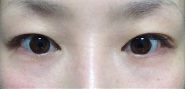 Jpirasutokbfbcl ベストコレクション 一重 二重 片方 一重 二重 片方ずつ