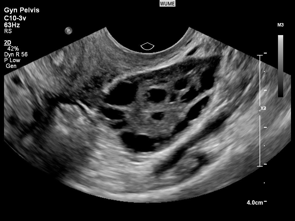 We did not find results for: Gynaecology Ultrasound Women S Ultrasound Melbourne