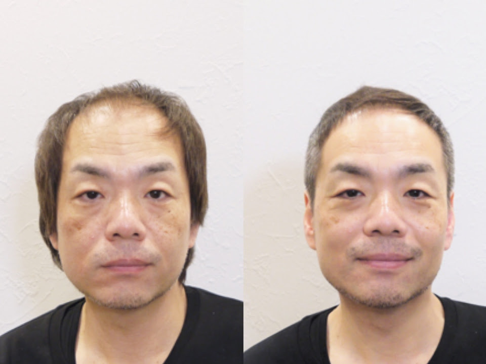 40 代 男性 髪型