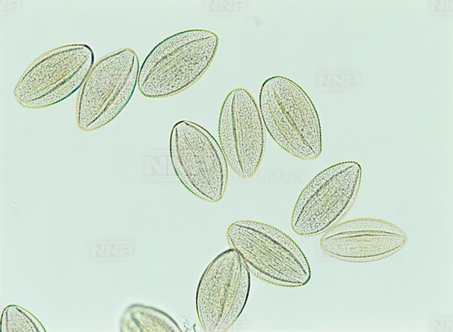 へちま 花粉 1614 ヘチマ 花粉 特徴 Berkahpictureq10gu