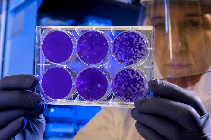 In this 2019 photo, a Centers for Disease Control and Prevention (CDC) scientist was examining the results of a plaque assay.