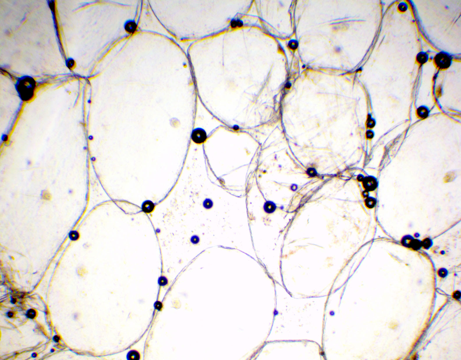 The higher the magnification of the condenser, the more the image clarity. Diagram Diagram Of Tomato Cell Full Version Hd Quality Tomato Cell Ahadiagram Umbertideturismo It
