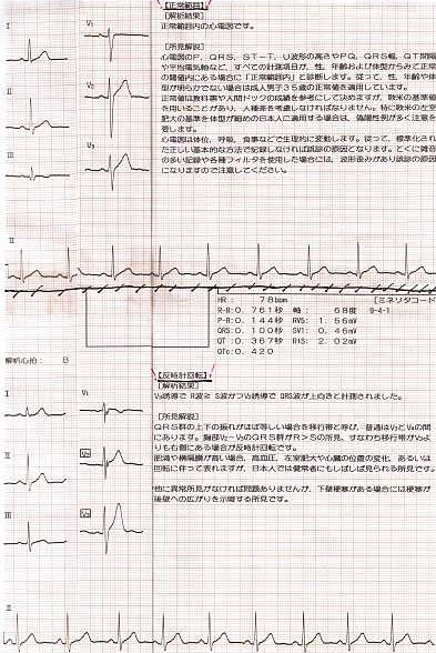 心電図 反時計軸回転 人気のある画像を投稿する