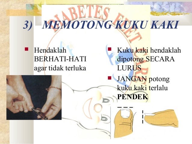 Kesan Ubat Diabetes - Notable a