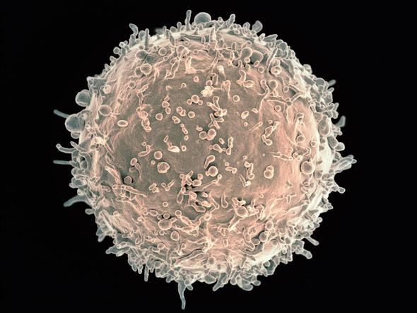 Colorized electron micrograph of human B cell