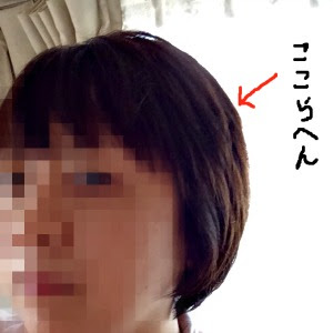 画像 髪 伸びない 病気 髪 伸びない 病気 Gambarsaetri
