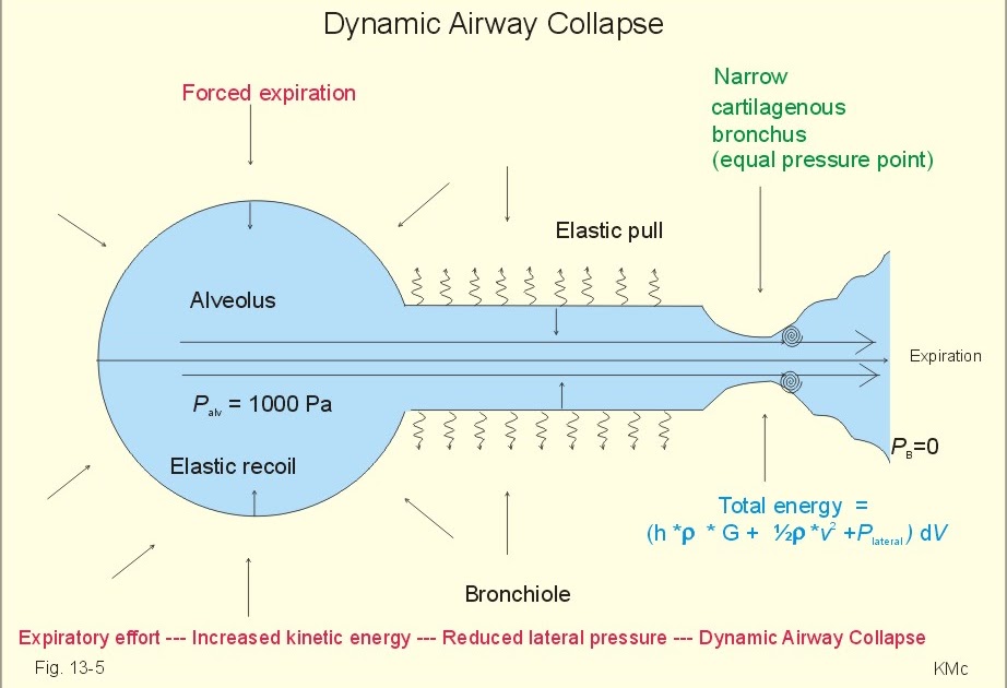 Air Trapping Copd à¸„à¸·à¸­ - Perokok n