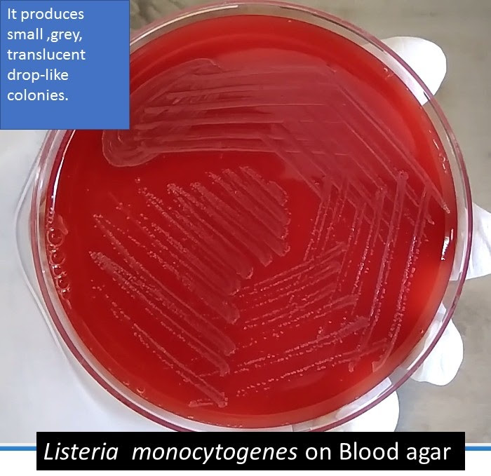 In direct smears that are gram. Listeria On Blood Agar Introduction Morphology Culture Characteristics