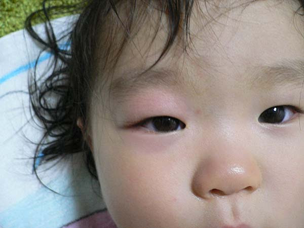 エレガント子供 目の周り 赤い かわいい子供たちの画像