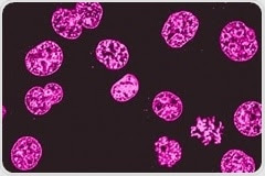 Fluorescence Microscopy vs. Light Microscopy